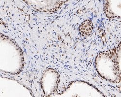 Invitrogen HMGB2 Monoclonal Antibody (10D1) 100 &mu;L; Unconjugated:Antibodies,