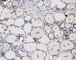 Invitrogen HMGB2 Monoclonal Antibody (10D1) 100 &mu;L; Unconjugated:Antibodies,