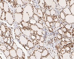 Invitrogen NuMA Monoclonal Antibody (A3A2) 100 &mu;L; Unconjugated:Antibodies,