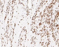 Invitrogen NuMA Monoclonal Antibody (A3A2) 100 &mu;L; Unconjugated:Antibodies,