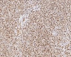 Invitrogen NuMA Monoclonal Antibody (A3A2) 100 &mu;L; Unconjugated:Antibodies,