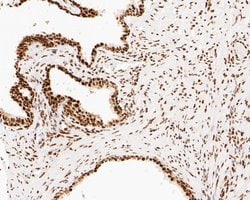 Invitrogen NuMA Monoclonal Antibody (A3A2) 100 &mu;L; Unconjugated:Antibodies,