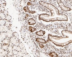 Invitrogen NuMA Monoclonal Antibody (A3A2) 100 &mu;L; Unconjugated:Antibodies,
