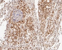 Invitrogen NuMA Monoclonal Antibody (A3A2) 100 &mu;L; Unconjugated:Antibodies,