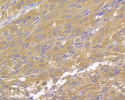 Invitrogen DAPK1 Monoclonal Antibody (12B1) 100 &mu;L; Unconjugated:Antibodies,