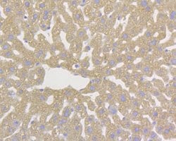 Invitrogen DAPK1 Monoclonal Antibody (12B1) 100 &mu;L; Unconjugated:Antibodies,