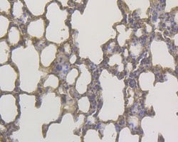 Invitrogen DAPK1 Monoclonal Antibody (12B1) 100 &mu;L; Unconjugated:Antibodies,