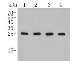 Invitrogen BAG2 Recombinant Rabbit Monoclonal Antibody (JE47-57) 100 &mu;L;