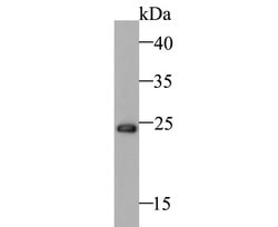 Invitrogen BAG2 Recombinant Rabbit Monoclonal Antibody (JE47-57) 100 &mu;L;