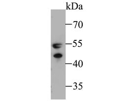 Invitrogen WARS Recombinant Rabbit Monoclonal Antibody (JE48-08) 100 &mu;L | Buy Online | Invitrogen&trade; | Fisher Scientific