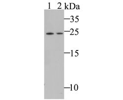 Invitrogen MAD3 Recombinant Rabbit Monoclonal Antibody (JE48-14) 100 &mu;L | Buy Online | Invitrogen&trade; | Fisher Scientific