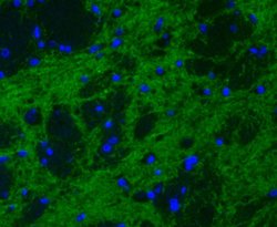 Invitrogen Synapsin II Recombinant Rabbit Monoclonal Antibody (JE49-03)