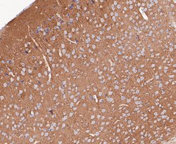 Invitrogen Synapsin II Recombinant Rabbit Monoclonal Antibody (JE49-03)