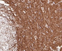 Invitrogen Synapsin II Recombinant Rabbit Monoclonal Antibody (JE49-03)