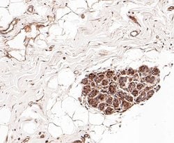 Invitrogen PRKAR2A Recombinant Rabbit Monoclonal Antibody (JE49-49) 100