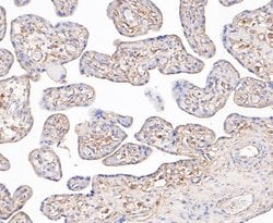 Invitrogen PRKAR2A Recombinant Rabbit Monoclonal Antibody (JE49-49) 100