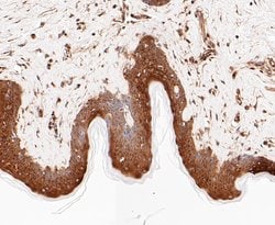 Invitrogen PRKAR2A Recombinant Rabbit Monoclonal Antibody (JE49-49) 100