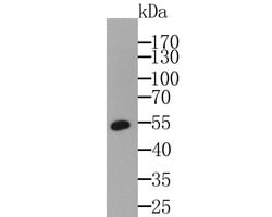 Invitrogen PRKAR2A Recombinant Rabbit Monoclonal Antibody (JE49-49) 100