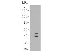 CD16 Recombinant Rabbit Monoclonal Antibody (JE49-79), Invitrogen&trade; 100 &mu;L; Unconjugated 