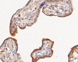 Invitrogen Phospho-ErbB3 (Tyr1222) Recombinant Rabbit Monoclonal Antibody