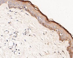 Invitrogen Phospho-ErbB3 (Tyr1222) Recombinant Rabbit Monoclonal Antibody