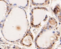 Invitrogen Phospho-ErbB3 (Tyr1222) Recombinant Rabbit Monoclonal Antibody