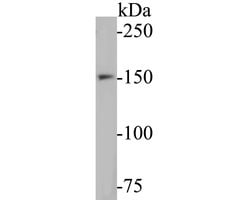 Invitrogen WRN Recombinant Rabbit Monoclonal Antibody (JE52-72) 100 &mu;L;