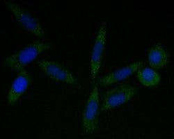 Invitrogen Tropomodulin 2 Recombinant Rabbit Monoclonal Antibody (JE53-06)