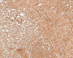 Invitrogen Tropomodulin 2 Recombinant Rabbit Monoclonal Antibody (JE53-06)
