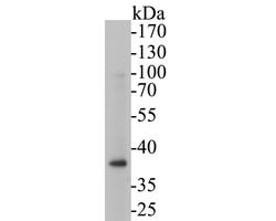Invitrogen Tropomodulin 2 Recombinant Rabbit Monoclonal Antibody (JE53-06)