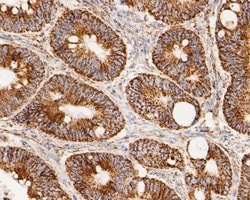 Invitrogen LDHD Recombinant Rabbit Monoclonal Antibody (JE53-15) 100 &mu;L;