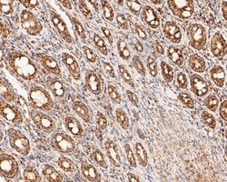 Invitrogen LDHD Recombinant Rabbit Monoclonal Antibody (JE53-15) 100 &mu;L;