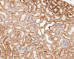 Invitrogen LDHD Recombinant Rabbit Monoclonal Antibody (JE53-15) 100 &mu;L;