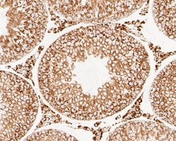 Invitrogen LDHD Recombinant Rabbit Monoclonal Antibody (JE53-15) 100 &mu;L;