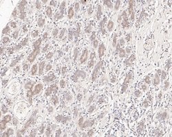 Invitrogen SENP2 Recombinant Rabbit Monoclonal Antibody (JE52-69) 100 &mu;L | Buy Online | Invitrogen&trade; | Fisher Scientific