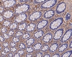 Invitrogen eIF3b Recombinant Rabbit Monoclonal Antibody (JE54-00) 100 &mu;L;