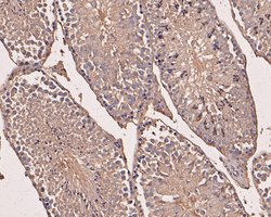 Invitrogen eIF3b Recombinant Rabbit Monoclonal Antibody (JE54-00) 100 &mu;L;