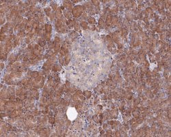 Invitrogen SPAK Recombinant Rabbit Monoclonal Antibody (JE53-64) 100 &mu;L;