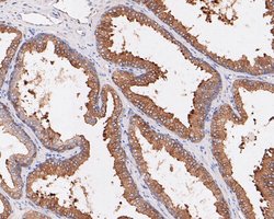Invitrogen SPAK Recombinant Rabbit Monoclonal Antibody (JE53-64) 100 &mu;L;