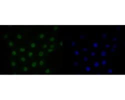 Invitrogen HMGN2 Recombinant Rabbit Monoclonal Antibody (JE53-85) 100 &mu;L;