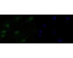 Invitrogen HMGN2 Recombinant Rabbit Monoclonal Antibody (JE53-85) 100 &mu;L;