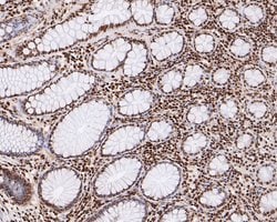 Invitrogen HMGN2 Recombinant Rabbit Monoclonal Antibody (JE53-85) 100 &mu;L;