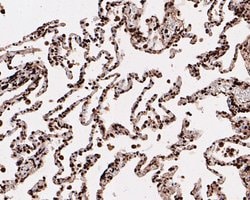 Invitrogen HMGN2 Recombinant Rabbit Monoclonal Antibody (JE53-85) 100 &mu;L;