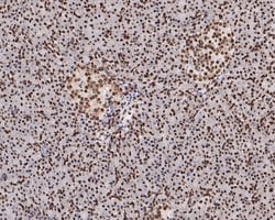 Invitrogen HMGN2 Recombinant Rabbit Monoclonal Antibody (JE53-85) 100 &mu;L;