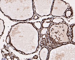 Invitrogen HMGN2 Recombinant Rabbit Monoclonal Antibody (JE53-85) 100 &mu;L;