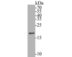 Invitrogen HMGN2 Recombinant Rabbit Monoclonal Antibody (JE53-85) 100 &mu;L;