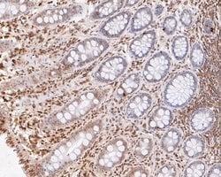 Invitrogen eIF3e Recombinant Rabbit Monoclonal Antibody (JE53-63) 100 &mu;L;