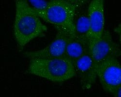 Invitrogen ECM1 Recombinant Rabbit Monoclonal Antibody (JE54-17) 100 &mu;L;