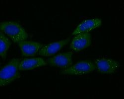 Invitrogen ECM1 Recombinant Rabbit Monoclonal Antibody (JE54-17) 100 &mu;L;