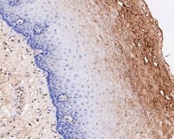 Invitrogen ECM1 Recombinant Rabbit Monoclonal Antibody (JE54-17) 100 &mu;L;